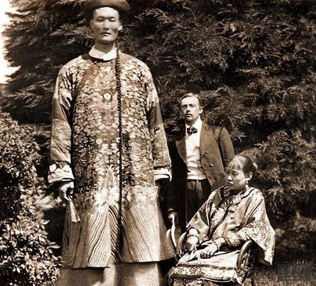 世界历史上最高的人詹世钗，身高达到3.19米